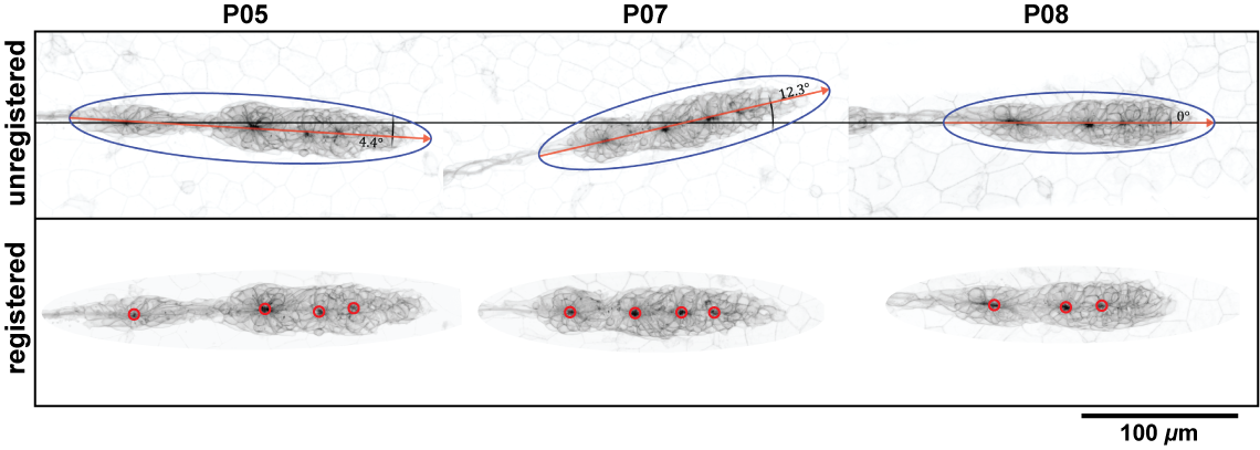 Registration of 3D data. (unregistered) location and orientation of the unregistered MaxIPs in XY. The red line indicates the angle in degrees from the horizontal midline. The blue oval indicates registration ROI as determined by the macro. (registered) pLLPs after XY transformation took place. red circles indicate rosette centers as detected by the macro based on maximum signal intensity.