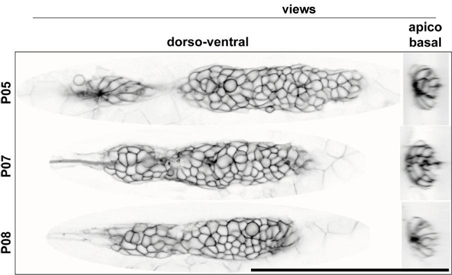 cldnb:lyn-gfp fluorescence signal in a cross-section of the pLLP (Obj.: 40X APO, scale bar = 100 \(\mu\)m)