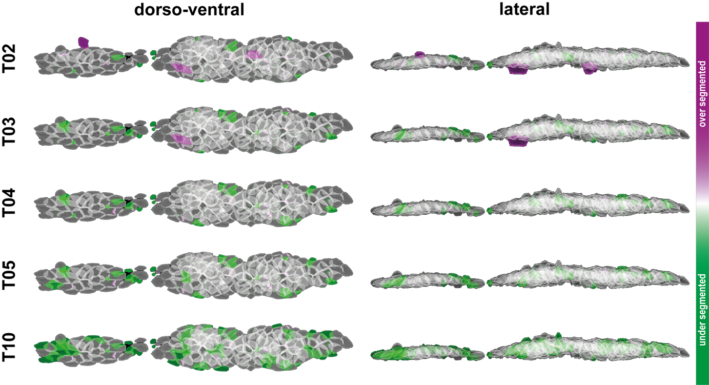 Graphical comparison of the thresholds tested. Volume renderings have been done with IJ’s VolumeViewer