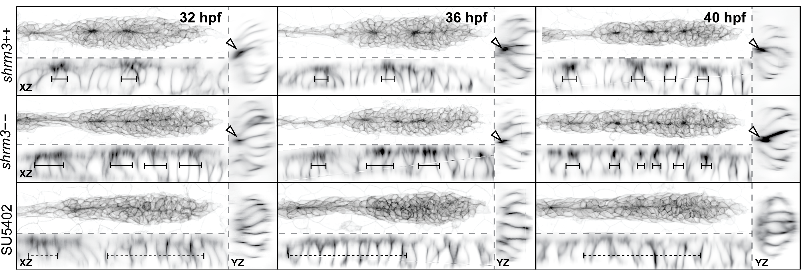 Apical Constriction in 3D. Stages are in columns, the groups are in rows. Each panel shows a MaxIP (top left), and orthogonal views along the length (XZ, bottom left) and the width (YZ, right). Arrow annotations in YZ panels indicate points of constriction. Bar annotations in XZ indicate the spread of region of constriction.