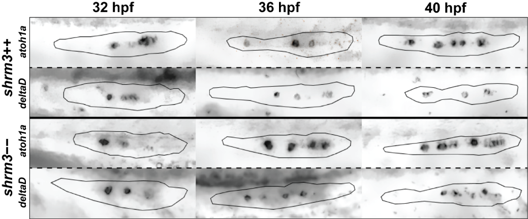 Expression of deltaD and atoh1a in the pLLP. Recorded in greyscale at brightfield at 20X Magnification. Images show background subtracted and de-noised EDFs of original Z-stack data.