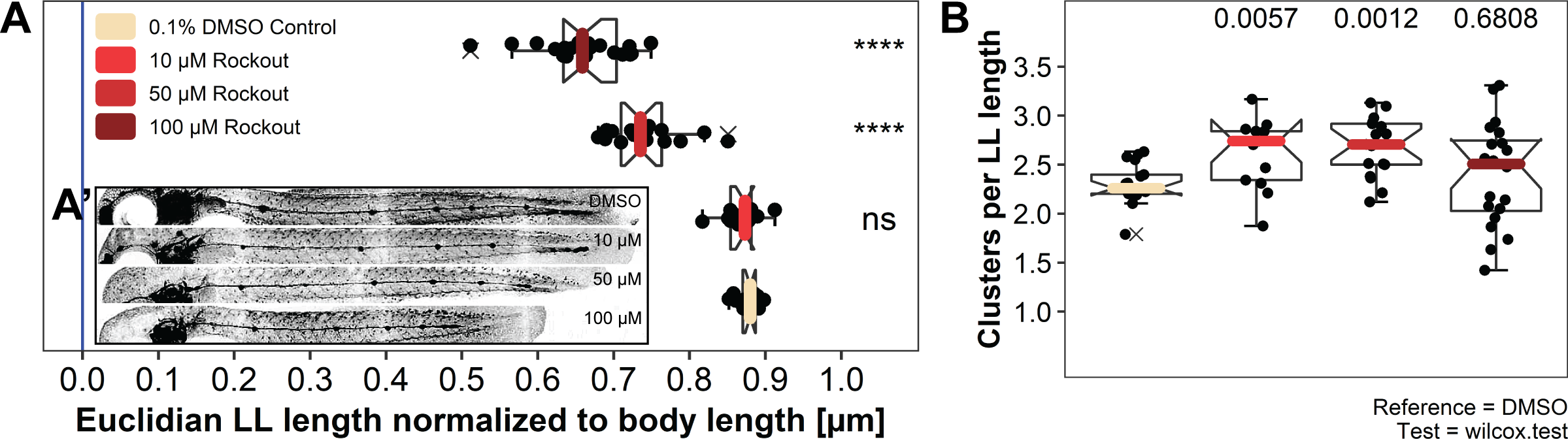Titration of Rock inhibitor. A LL lengths are reduced with increased concentrations of Rock inhibitor and B groupwise comparison of the length normalized cluster count per concentration of Rock inhibitor.